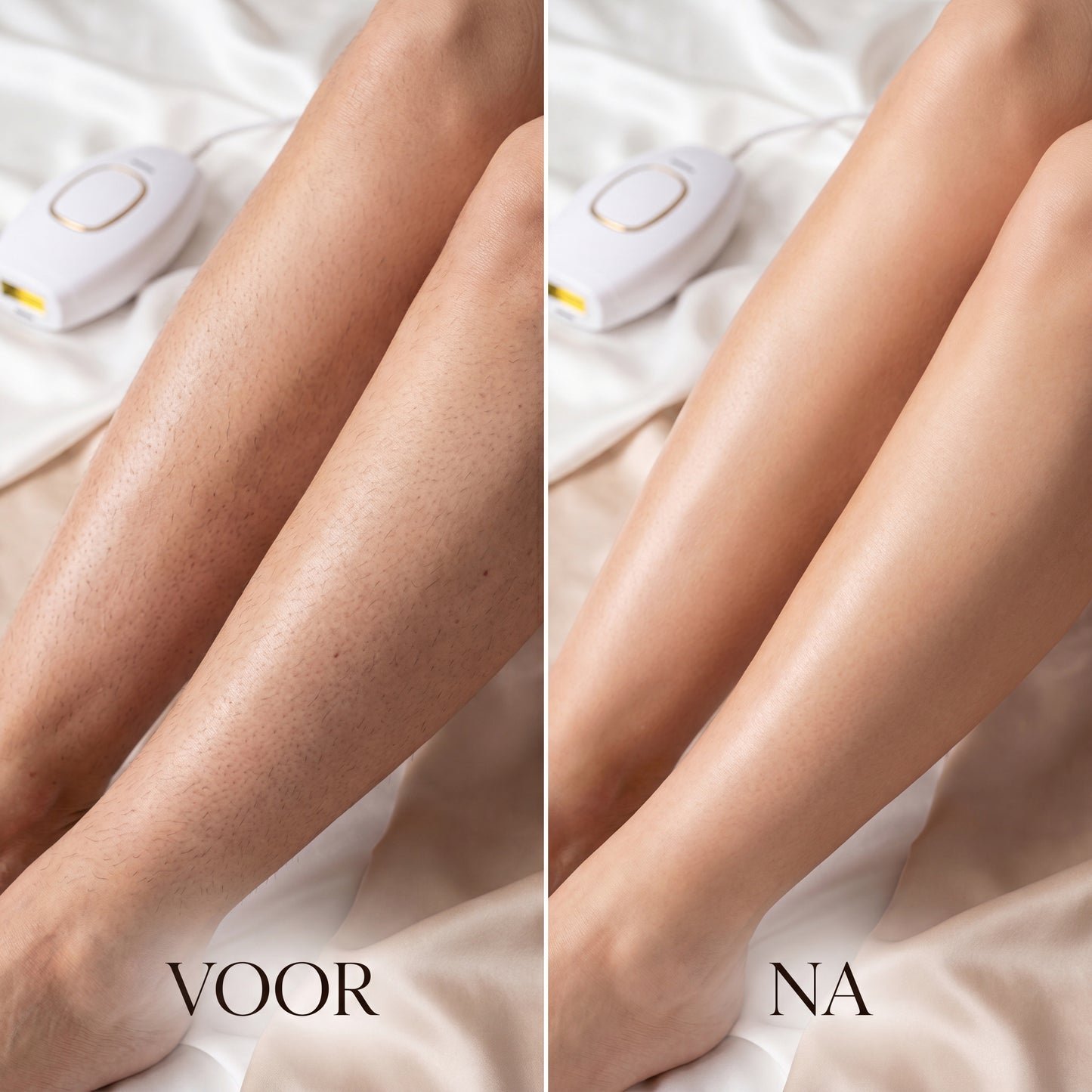 FreeSkin™ IPL – Langdurig gladde huid zonder salonbezoeken